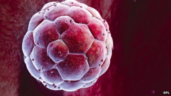 _69879849_p6800679-human_blastocyst-spl