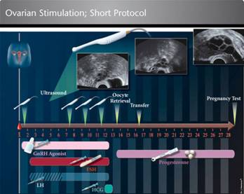 Ovulation-Induction_ShortProtocol